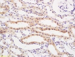 RBBP6/P2P-R Rabbit anti-Human, Polyclonal, Bioss 100 &mu;L; Unconjugated:Antibodies,