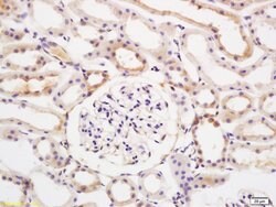 E2AK2/PKR Rabbit anti-Human, Polyclonal, Bioss 100 &mu;L; Unconjugated:Antibodies,