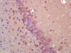 E2AK2/PKR Rabbit anti-Human, Polyclonal, Bioss 100 &mu;L; Unconjugated:Antibodies,