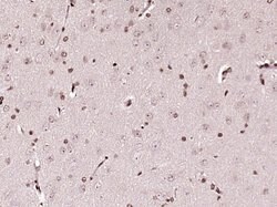 C1orf103 Rabbit anti-Human, Polyclonal, Bioss 100 &mu;L; Unconjugated:Antibodies,