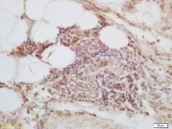 C1orf106 Rabbit anti-Human, Polyclonal, Bioss 100 &mu;L; Unconjugated:Antibodies,