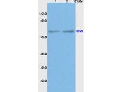 BMPR1A/CD292 Rabbit anti-Human, Polyclonal, Bioss 100 &mu;L; Unconjugated:Antibodies,