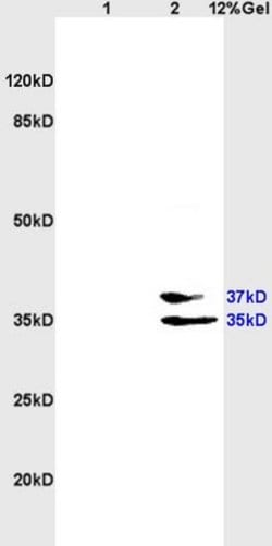 EpCAM/CD326 Rabbit anti-Human, Polyclonal, Bioss 100 &mu;L; Unconjugated:Antibodies,