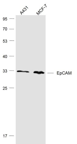 EpCAM/CD326 Rabbit anti-Human, Polyclonal, Bioss 100 &mu;L; Unconjugated:Antibodies,