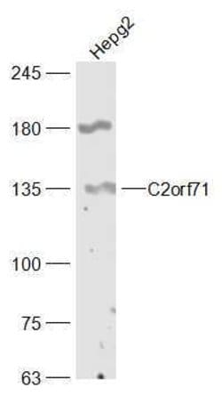 C2orf71 Rabbit anti-Human, Polyclonal, Bioss 100 &mu;L; Unconjugated:Antibodies,