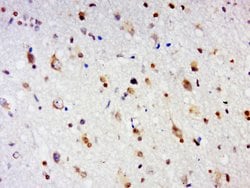 GPCR EX33 Rabbit anti-Human, Polyclonal, Bioss 100 &mu;L; Unconjugated:Antibodies,