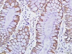 GPCR EX33 Rabbit anti-Human, Polyclonal, Bioss 100 &mu;L; Unconjugated:Antibodies,