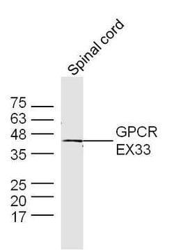 GPCR EX33 Rabbit anti-Human, Polyclonal, Bioss 100 &mu;L; Unconjugated:Antibodies,