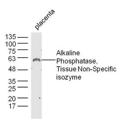 AP-TNAP/ALPL Rabbit anti-Human, Polyclonal, Bioss 100 &mu;L; Unconjugated:Antibodies,