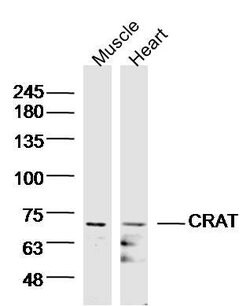 CRAT/CAT1 Rabbit anti-Human, Polyclonal, Bioss 100 &mu;L; Unconjugated:Antibodies,