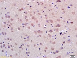 CHIP Rabbit anti-Human, Polyclonal, Bioss 100 &mu;L; Unconjugated:Antibodies,