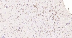 CHIP Rabbit anti-Human, Polyclonal, Bioss 100 &mu;L; Unconjugated:Antibodies,