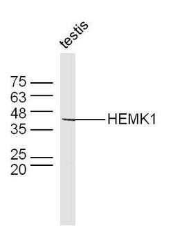 HEMK1 Rabbit anti-Human, Polyclonal, Bioss 100 &mu;L; Unconjugated:Antibodies,