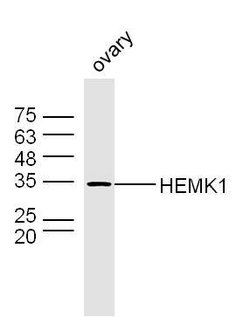 HEMK1 Rabbit anti-Human, Polyclonal, Bioss 100 &mu;L; Unconjugated:Antibodies,