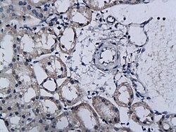 TPA Rabbit anti-Human, Polyclonal, Bioss 100 &mu;L; Unconjugated:Antibodies,