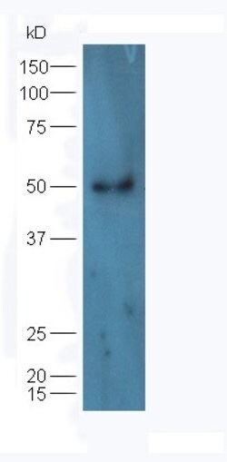 hHR23b Rabbit anti-Human, Polyclonal, Bioss 100 &mu;L; Unconjugated:Antibodies,