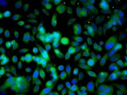 Ubiquitin Rabbit anti-Human, Polyclonal, Bioss 100 &mu;L; Unconjugated:Antibodies,