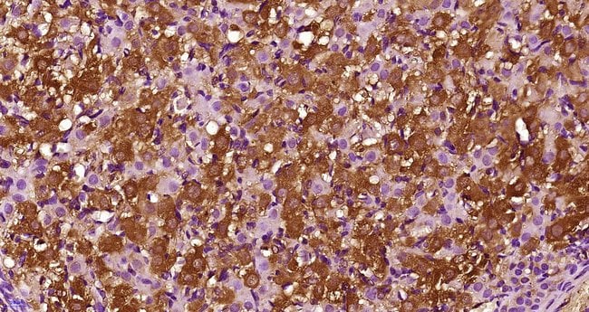 Anti-CD163 Antibody [M130/2164] (A253786) | Antibodies.com
