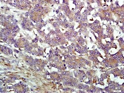 IFIT1B Rabbit anti-Human, Polyclonal, Bioss 100 &mu;L; Unconjugated:Antibodies,