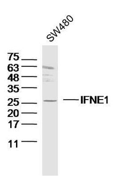 IFNE1 Rabbit anti-Human, Polyclonal, Bioss 100 &mu;L; Unconjugated:Antibodies,