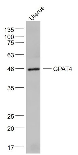 GPAT4 Rabbit anti-Human, Polyclonal, Bioss 100 &mu;L; Unconjugated:Antibodies,