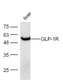 GLP-1R Rabbit anti-Human, Polyclonal, Bioss 100 &mu;L; Unconjugated:Antibodies,