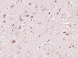 ATP7A Rabbit anti-Human, Polyclonal, Bioss 100 &mu;L; Unconjugated:Antibodies,