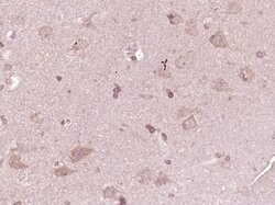 ATP7A Rabbit anti-Human, Polyclonal, Bioss 100 &mu;L; Unconjugated:Antibodies,