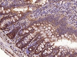 VEGF-C Rabbit anti-Human, Polyclonal, Bioss 100 &mu;L; Unconjugated:Antibodies,