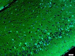 Gamma-Adaptin Rabbit anti-Human, Polyclonal, Bioss 100 &mu;L; Unconjugated:Antibodies,