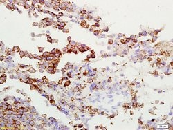 Gamma-Adaptin Rabbit anti-Human, Polyclonal, Bioss 100 &mu;L; Unconjugated:Antibodies,