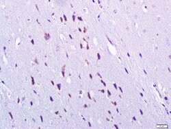 Gamma-Adaptin Rabbit anti-Human, Polyclonal, Bioss 100 &mu;L; Unconjugated:Antibodies,