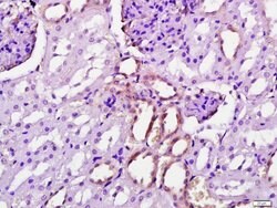 Gamma-Adaptin Rabbit anti-Human, Polyclonal, Bioss 100 &mu;L; Unconjugated:Antibodies,