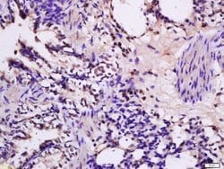 FKLF Rabbit anti-Human, Polyclonal, Bioss 100 &mu;L; Unconjugated:Antibodies,