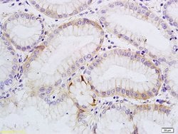 SATB1 Rabbit anti-Human, Polyclonal, Bioss 100 &mu;L; Unconjugated:Antibodies,