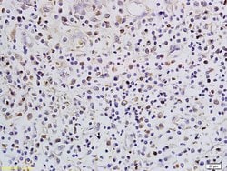SATB1 Rabbit anti-Human, Polyclonal, Bioss 100 &mu;L; Unconjugated:Antibodies,
