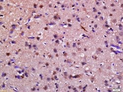 Syndetin Rabbit anti-Human, Polyclonal, Bioss 100 &mu;L; Unconjugated:Antibodies,