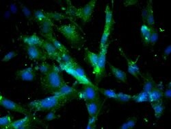 Cathepsin D/CTSD Rabbit anti-Human, Polyclonal, Bioss 100 &mu;L; Unconjugated:Antibodies,