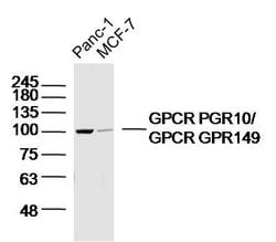 GPR149 Rabbit anti-Human, Polyclonal, Bioss 100 &mu;L; Unconjugated:Antibodies,