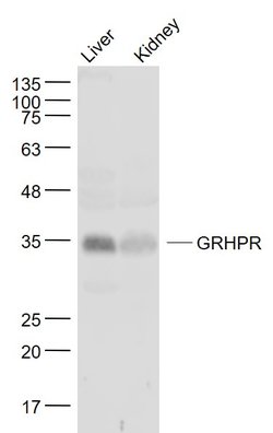 GRHPR Rabbit anti-Human, Polyclonal, Bioss 100 &mu;L; Unconjugated:Antibodies,