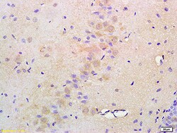 ATF6 Rabbit anti-Human, Polyclonal, Bioss 100 &mu;L; Unconjugated:Antibodies,