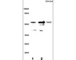 Phospho-CaMK2 (Thr287) Rabbit anti-Human, Polyclonal, Bioss 100 &mu;L;