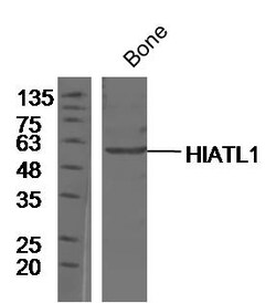 HIATL1 Rabbit anti-Human, Polyclonal, Bioss 100 &mu;L | Buy Online | Bioss | Fisher Scientific