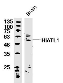 HIATL1 Rabbit anti-Human, Polyclonal, Bioss 100 &mu;L | Buy Online | Bioss | Fisher Scientific