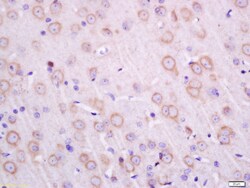 Transmembrane protein 30A Rabbit anti-Human, Polyclonal, Bioss 100 &mu;L;