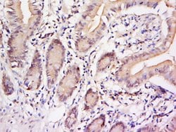 Phospho-STAT3 (Tyr705) Rabbit anti-Human, Polyclonal, Bioss 100 &mu;L;