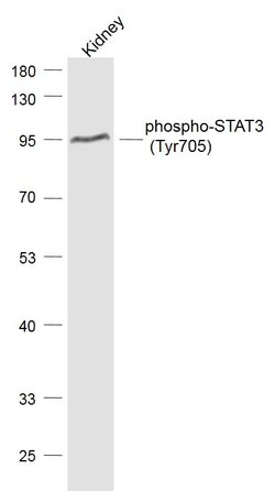 Phospho-STAT3 (Tyr705) Rabbit anti-Human, Polyclonal, Bioss 100 &mu;L;