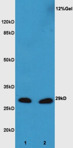 XBP1 Rabbit anti-Human, Polyclonal, Bioss 100 &mu;L; Unconjugated:Antibodies,