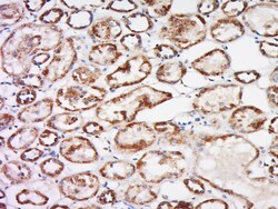 Trehalase Rabbit anti-Human, Polyclonal, Bioss 100 &mu;L; Unconjugated:Antibodies,