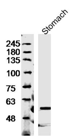 Trehalase Rabbit anti-Human, Polyclonal, Bioss 100 &mu;L; Unconjugated:Antibodies,